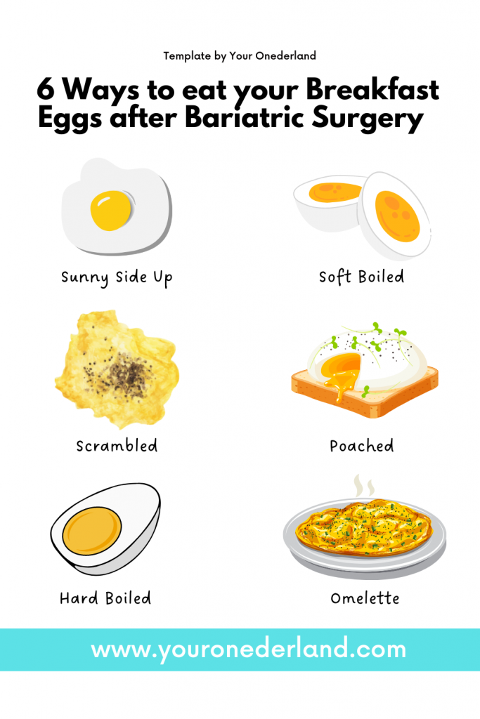 This image shows 6 different types of cooking styles for eggs.
